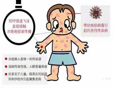 【秋冬季传染病预防—（预防水痘小常识）】