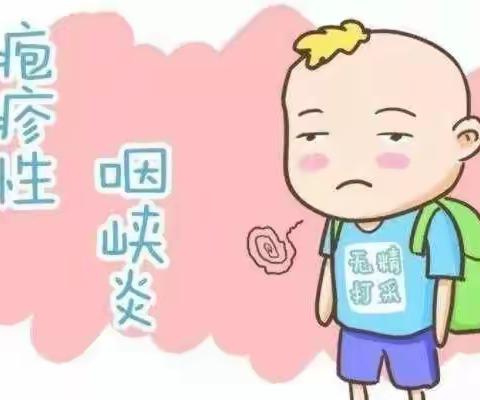 【卫生保健】疱疹性咽峡炎和幼儿夏季肠胃炎的预防