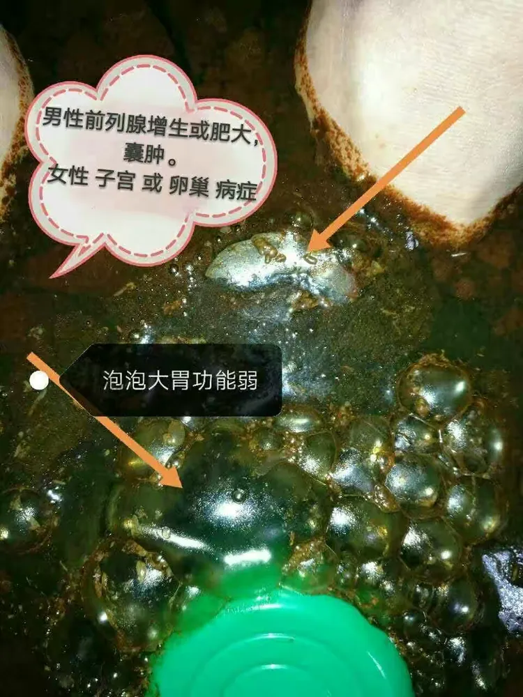 豫本草衡通仪部分详情分解