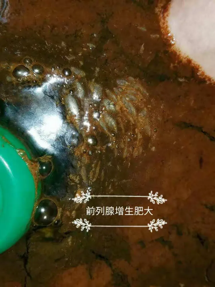 豫本草衡通仪部分详情分解