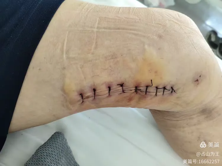 北京大學腫瘤醫(yī)院掛專科號核磁加急-北京大學腫瘤醫(yī)院現(xiàn)場掛號提前多長時間去 