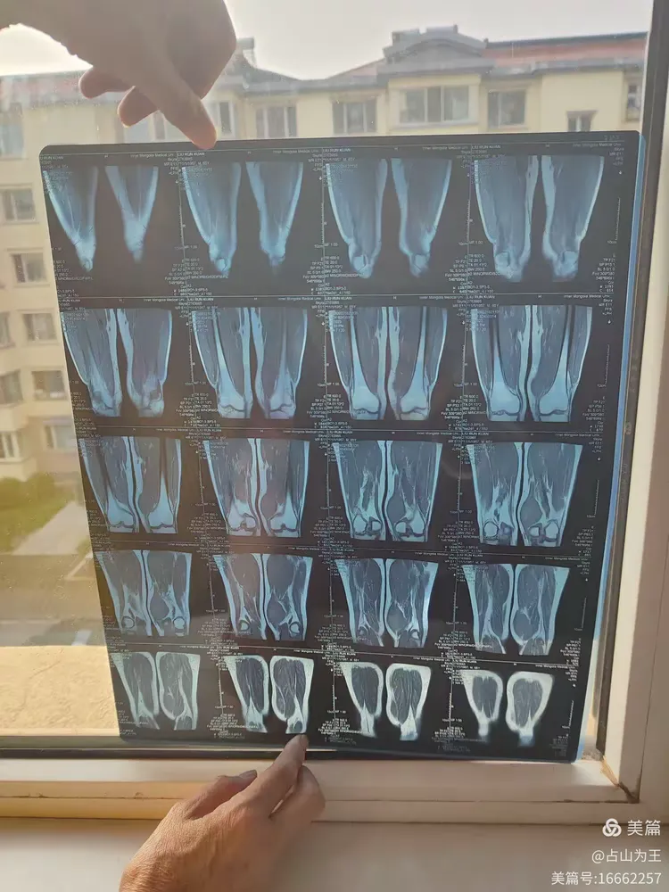 北京大学肿瘤医院健康管理核磁加急-北京大学肿瘤医院健康管理核磁加急多少钱 