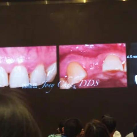 病历分析，切口