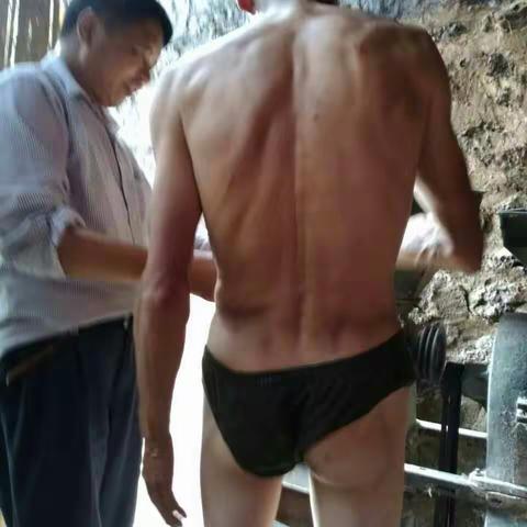 马关县皮防站站长带队到蔑厂开展二代血亲家系体检和中心校的学生体检