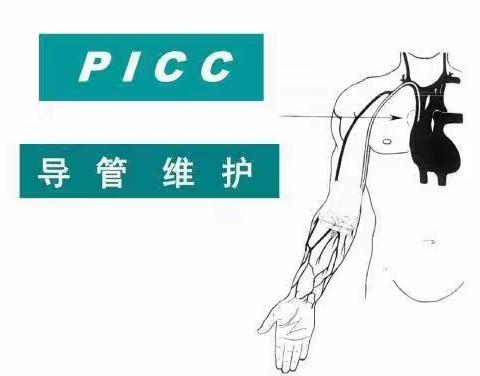 让爱回家——院外延伸护理服务之PICC维护