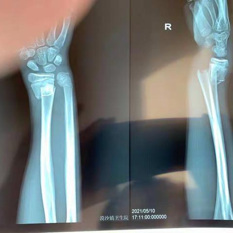 漠沙镇中心卫生院为您的健康保驾护航