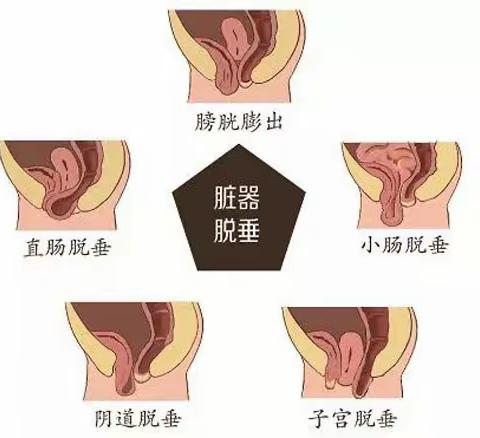 涨知识——三位襄城女性进行产后康复后竟然……