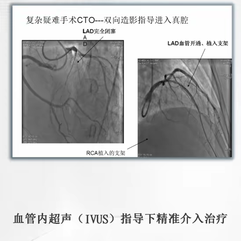 83集团军医院心肾内科科室简介