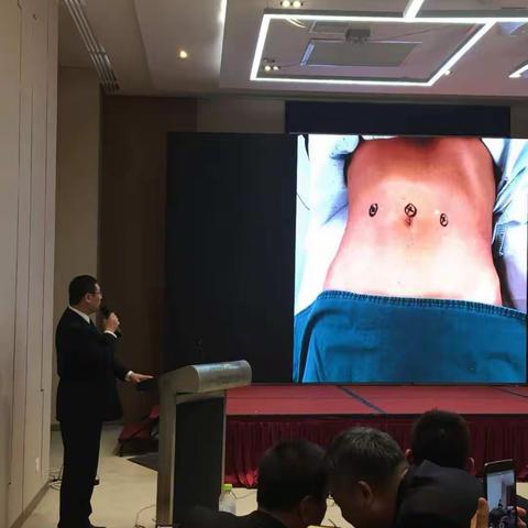 孙永强医师喜获腔镜疝手术视频大赛二等奖