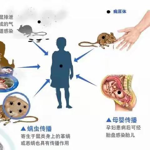 流行性出血热的防治知识——咸阳市机关幼儿园中华园