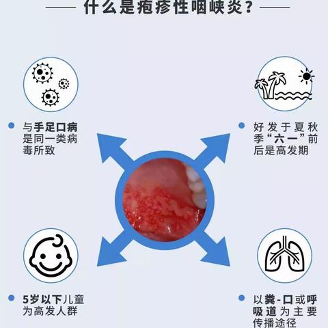 疱疹性咽颊炎高发期，请家长们注意防范