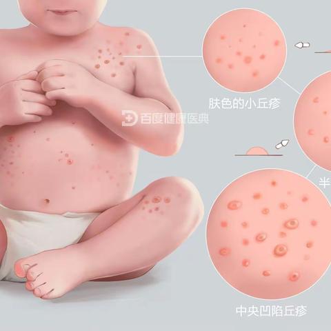 “水猴子”您了解吗？