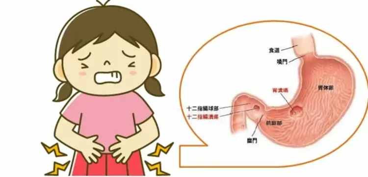 如果感觉自己有以下症状，请及时做胃功能四项检测！