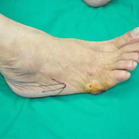 关于强拆，我有着深深地感悟。