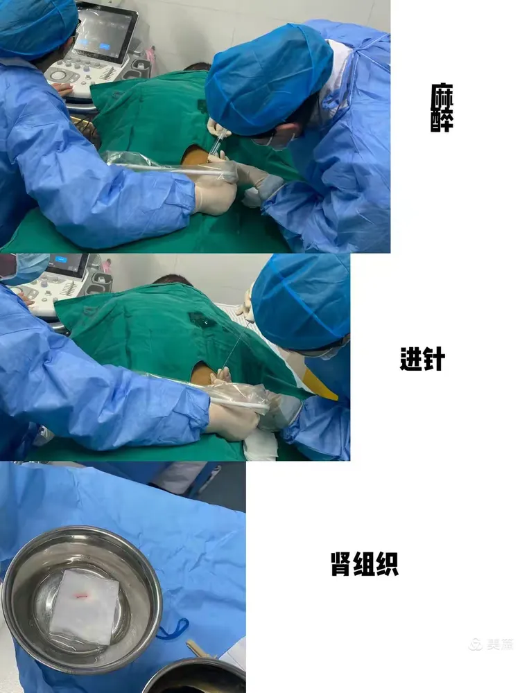 北京大学第一医院穿刺预约-北京医院穿刺医生叫什么名字哪科呀 