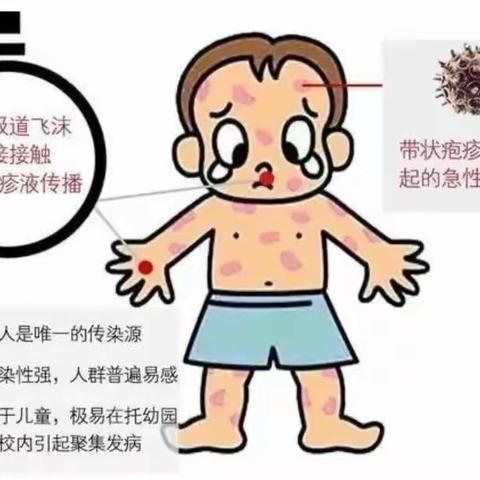 馨港幼儿园（分园）半壁店幼儿园—春季常见传染病预防健康宣教—大班