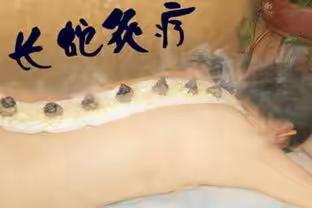 长蛇灸，温经补阳祛湿气，三伏天最好