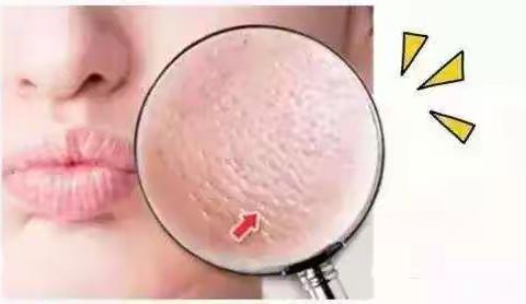 科普：毛孔粗大怎么办