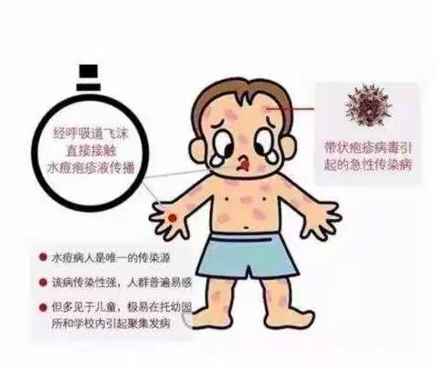 蓓蕾幼儿园预防水痘温馨提示