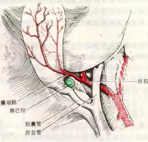 （南石医院结石病防治中心）并发症知多少-腹腔镜胆囊切除术——第八十讲