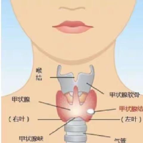 甲状腺科普之“情绪管理”