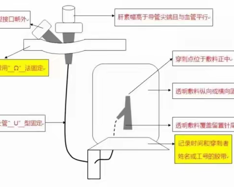 留置针的健康教育