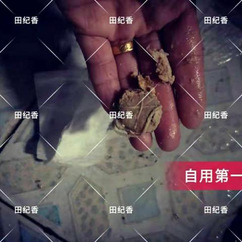 艳儿hpv35调理后面排出物