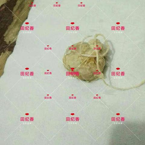 桃姐顾客阿姨59岁，宫颈囊肿