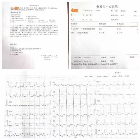 当急诊遇上静脉桥血管闭塞