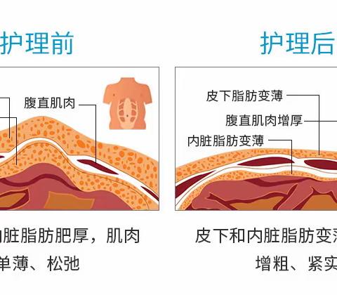 躺着也能瘦的懒人神器【美修斯】～