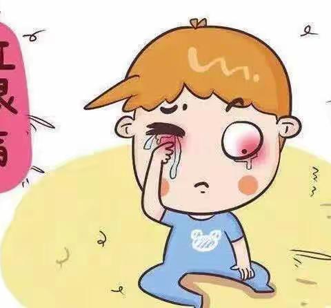 【预防红眼病 守护眼健康】向日葵幼儿园预防“红眼病”知识宣传