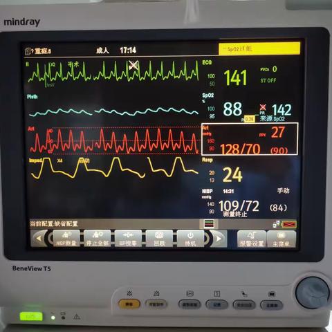 【周医·急诊与重症医学病区】有创动脉压监测——为病人安全保驾护航