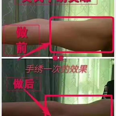 中医微整操作原理是什么？