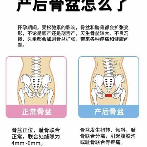 佳澜产后修复中心—骨盆修复