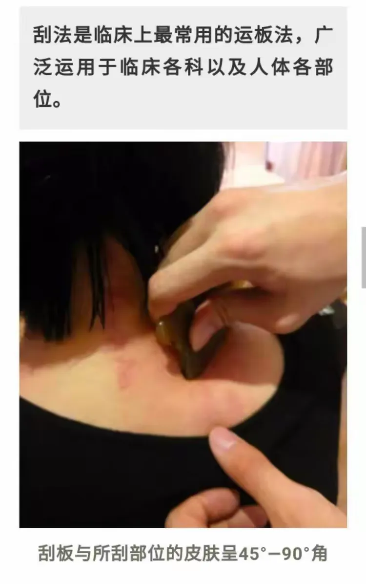 特种刮痧一一李湘授