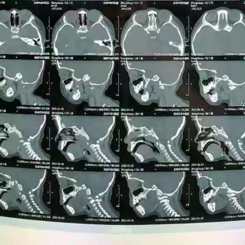 耳鼻咽喉通，畅快好轻松
