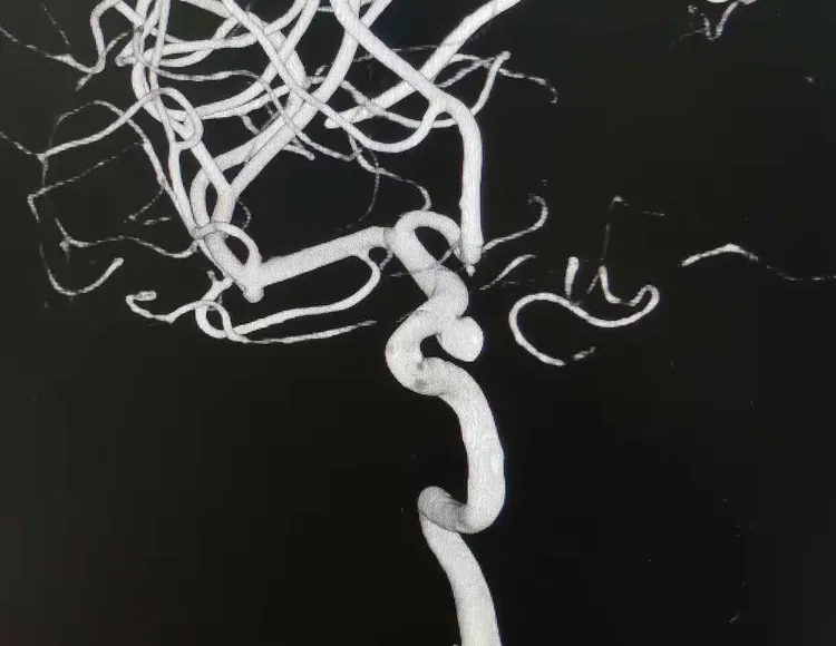 天坛医院穿刺预约-天坛医院穿刺预约流程 