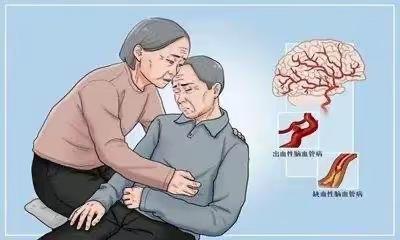 脑卒中患者阿司匹林药物知多少