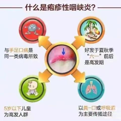 科学预防“疱疹性咽峡炎”