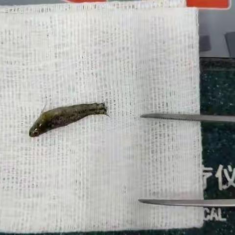 万宁市人民医院耳鼻咽喉科温謦提示