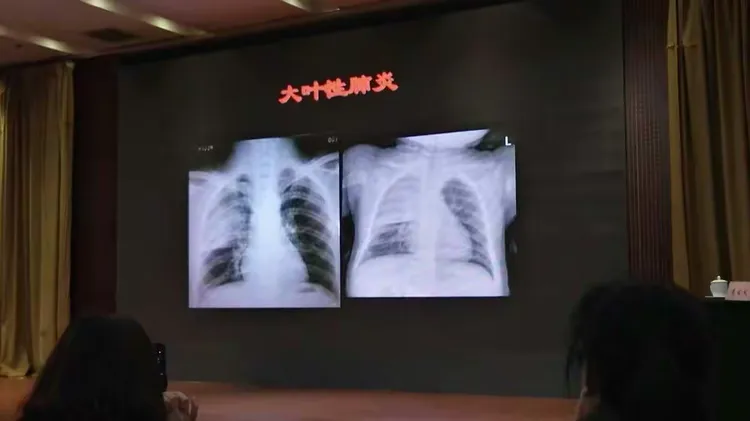胸部x线诊断
