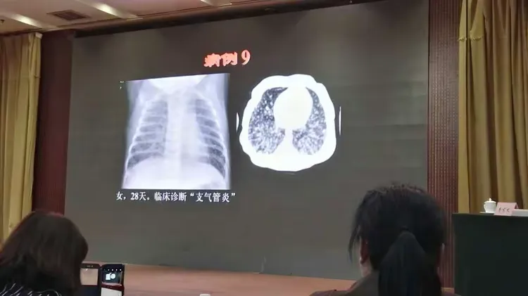 胸部x线诊断