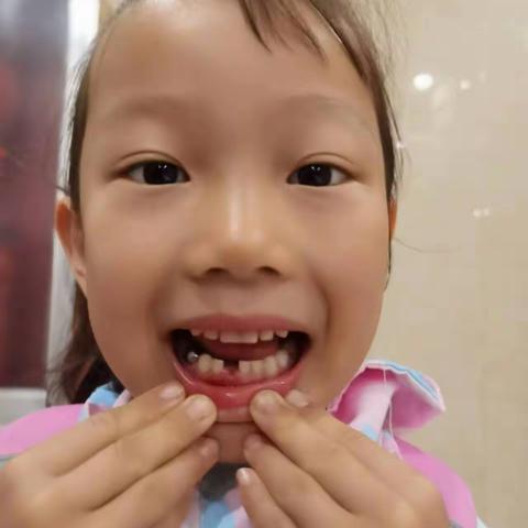 山西师大幼儿园大一班课程故事《牙齿咔咔咔》