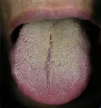 中医养生知识～杨舒老师讲课笔记之二