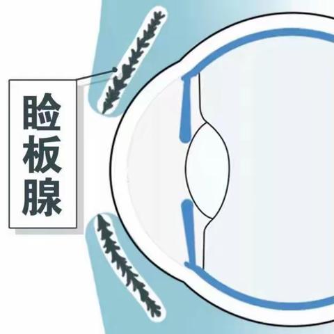 把眼睛里的“牙膏”挤出来，眼干就会缓解很多了！