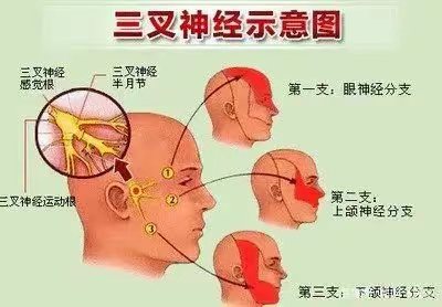 正确认识“天下第一痛”——三叉神经痛