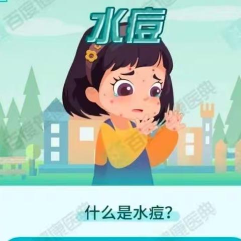 水痘的症状与预防早知道