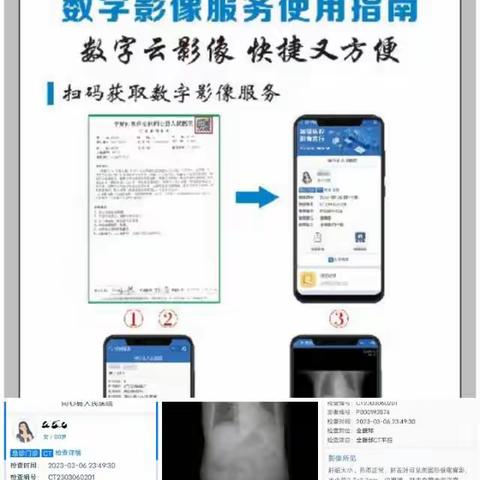 我院上线了“诊间支付”、“床旁结算”“云胶片”等功能啦