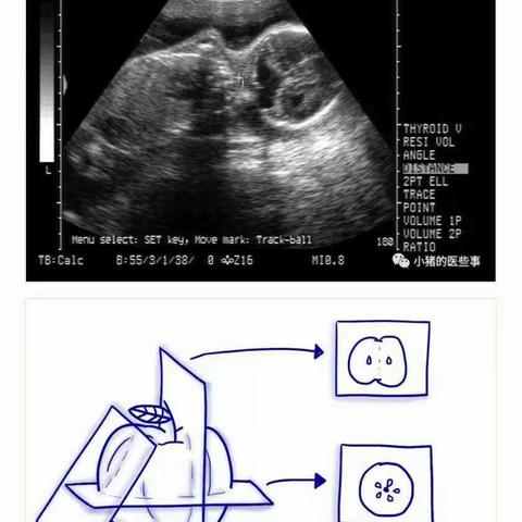 超声、X线、CT、MRI、该如何选择？