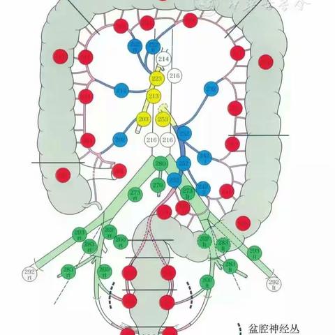 前进中的甘肃宝石花医院肛肠科   记我科完成我院及区域内首例全腹腔镜下全大肠切除术。